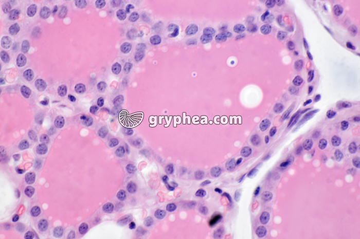 Thyroïde x200 - gryphea.com